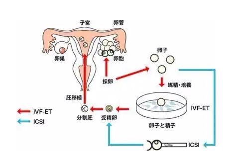 国内试管婴儿全部详细流程