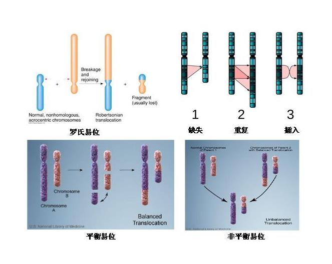 罗氏易位携带者做三代试管婴儿健康生育