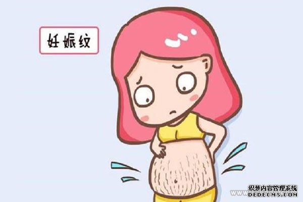 妊娠纹是什么样的