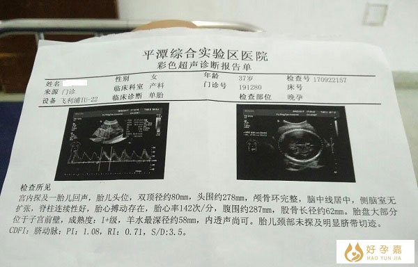 四维检查s/d数据报告单