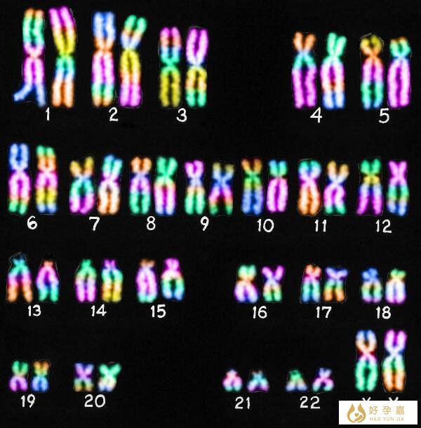 23对染色体